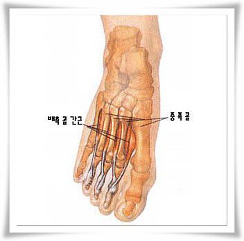 배측면의 내인성 근육