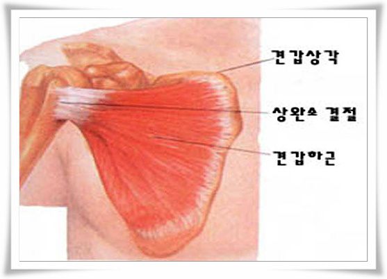 견갑하근-subscapularis